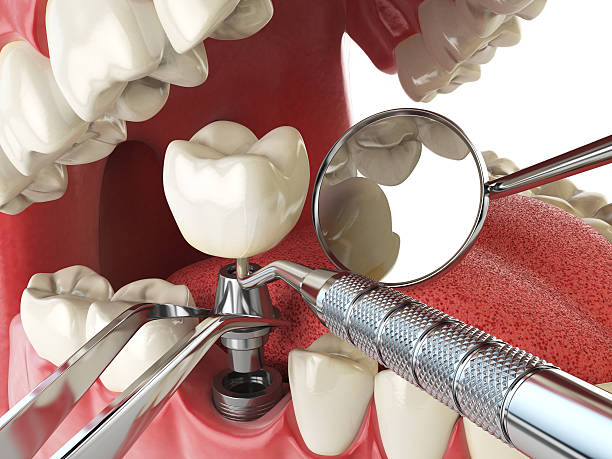 Best After-Hours Emergency Dentist in Lookout Mountain, GA